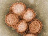 Вирус A/H1N1 под электронным микроскопом. Фото: wikipedia.org
