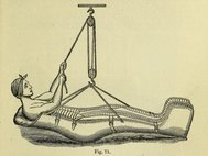 Иллюстрация из «Карманной книги хирурга» (Лондон, 1875)