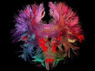 Модель нейронных связей в человеческом мозге