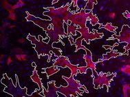 На фотографии, сделанной с помощью конфокального микроскопа, белым контуром выделен проводящий путь из кардиомиоцитов в монослое сердечной ткани (31% кардиомиоцитов и 69% непроводящих клеток). Кардиомиоциты помечены розовым цветом, ядра – синим