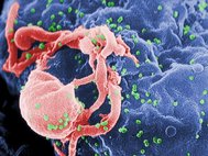 Вирусные частицы ВИЧ (выделены зеленым) на поверхности лимфоцита
