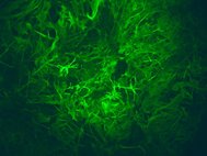 Астроциты, подкрашенные зелеными флуоресцентными антителами