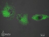 Изображение с флуоресцентного микроскопа. Культура фибробластов человека, обработанная синтезированным соединением, зеленым подсвечиваются ионы кальция внутри клеток, черные области внутри зеленых образований — клеточные ядра