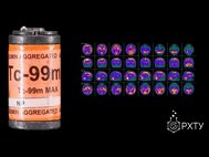 Изображения головного мозга при болезни Альцгеймера, полученные с помощью изотопа технеция (Tc-99m)