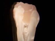 Экспериментальный образец зуба