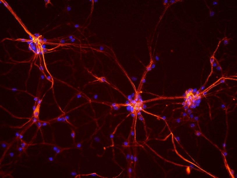 Упаковка ДНК в нейронах